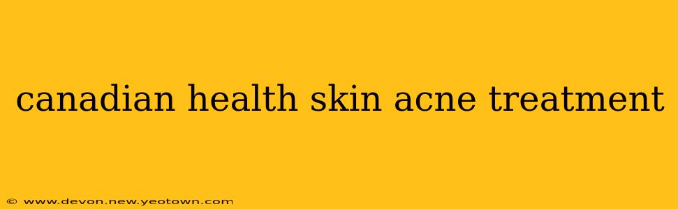 canadian health skin acne treatment