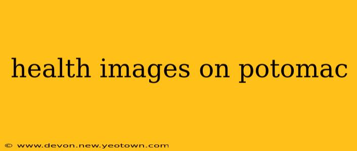 health images on potomac