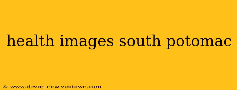 health images south potomac